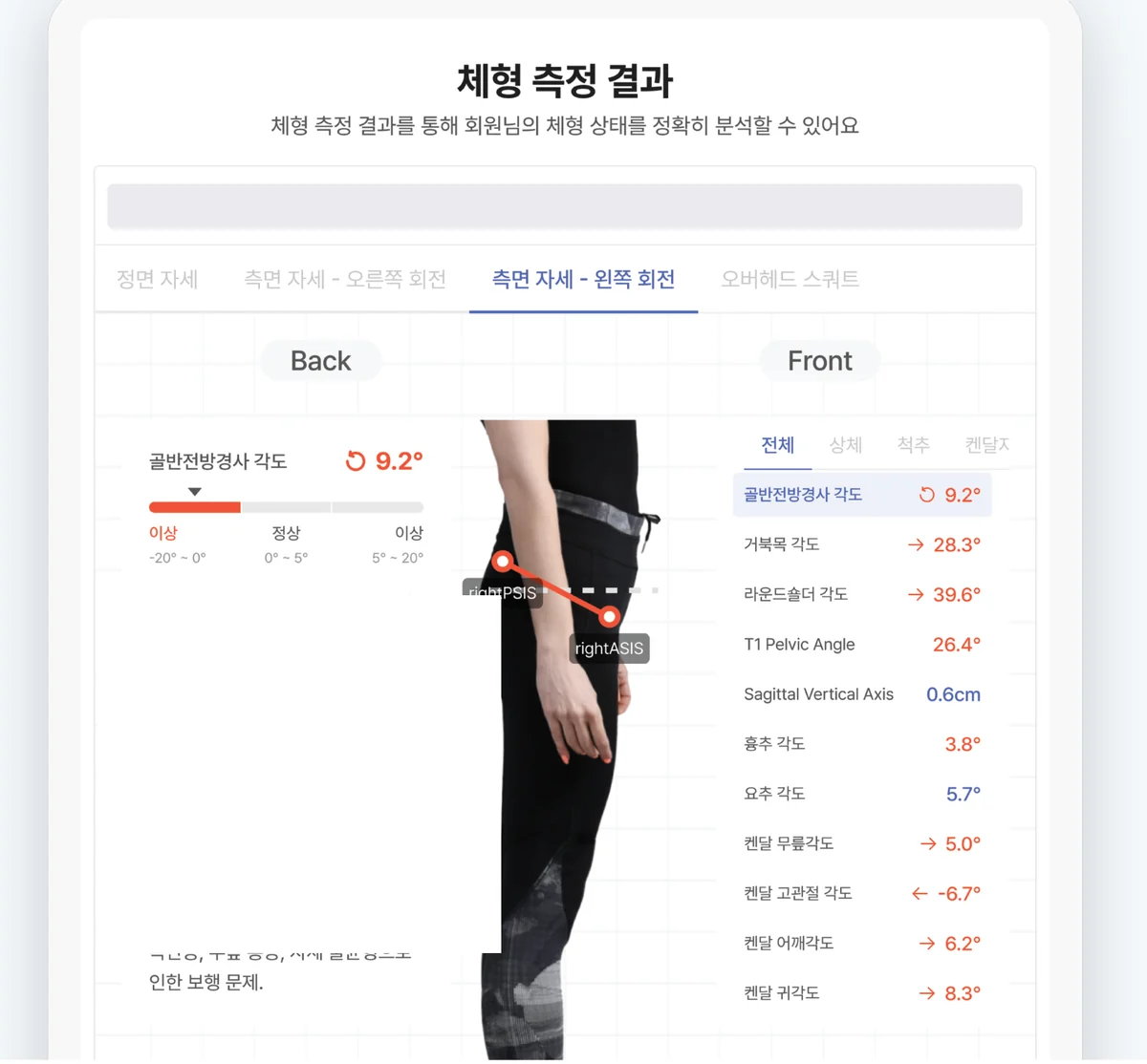 바디닷 체형 측정 결과 리포트 — 골반 기울기 각도
