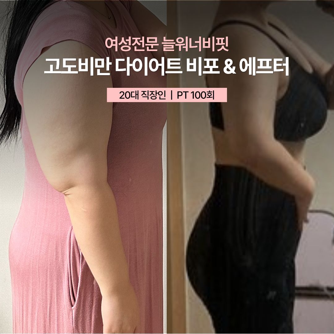 고도비만 다이어트 비포 애프터 — 20대 직장인 · PT 100회
