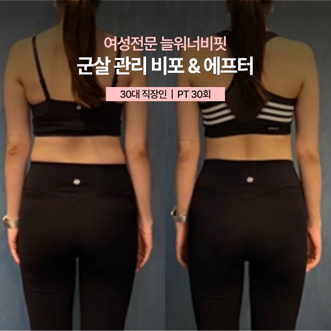 군살 관리 비포 애프터, 30대 직장인 · PT 30회