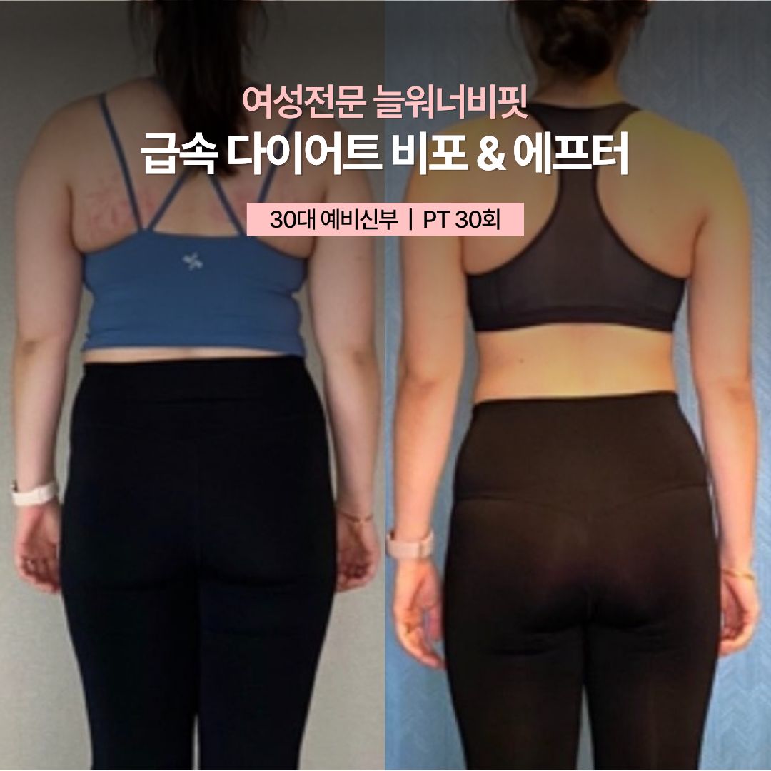 급속 다이어트 비포 애프터, 30대 예비신부 · PT 30회