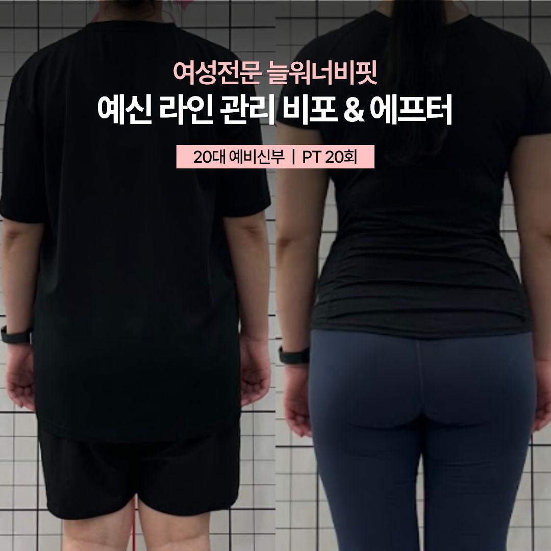 예신 라인 관리 비포 애프터, 20대 예비신부 · PT 20회