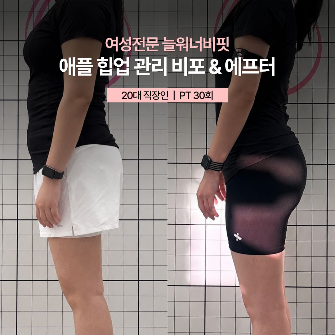 애플 힙업 관리 비포 애프터, 20대 직장인 · PT 30회