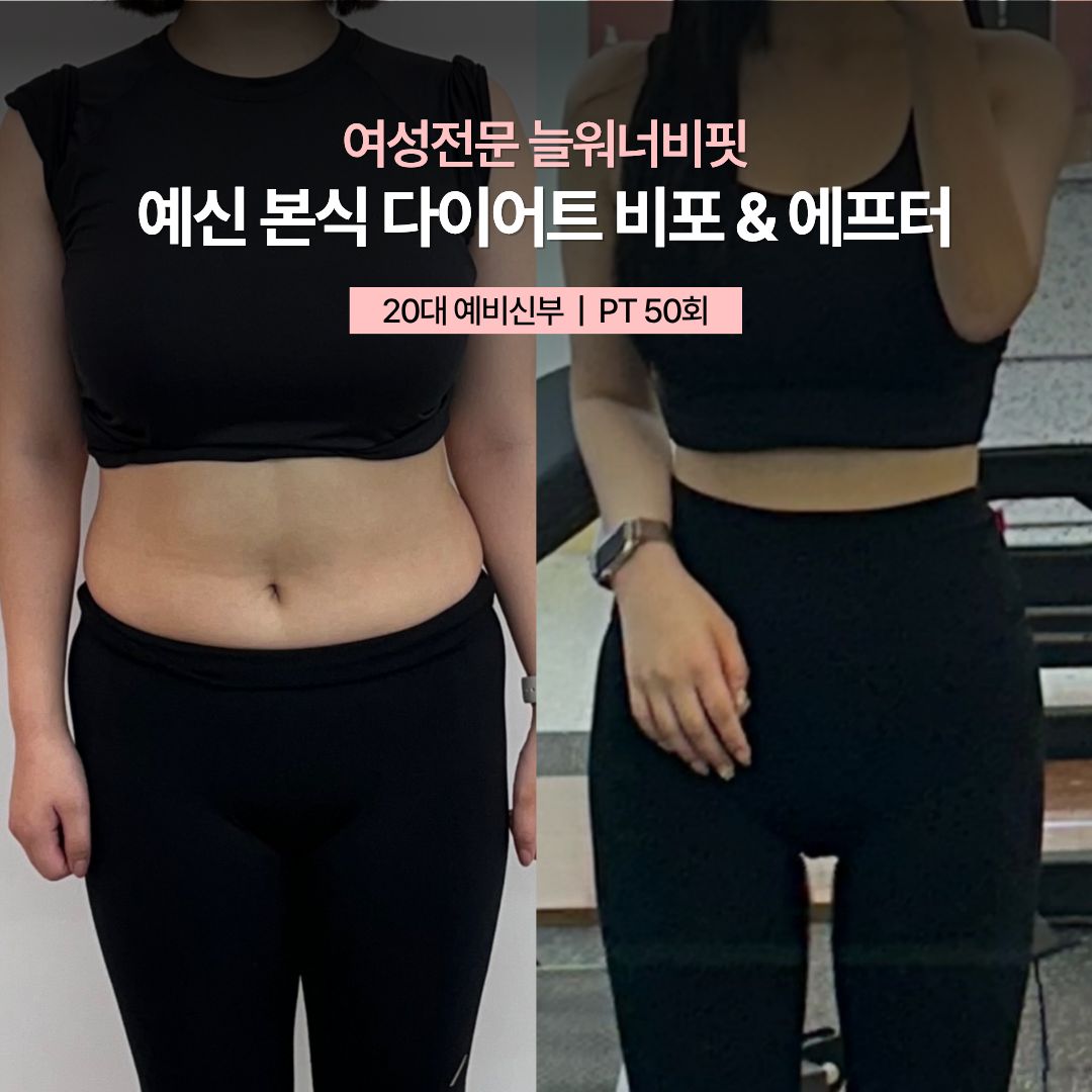 예신 본식 다이어트 비포 애프터, 20대 예비신부 · PT 50회