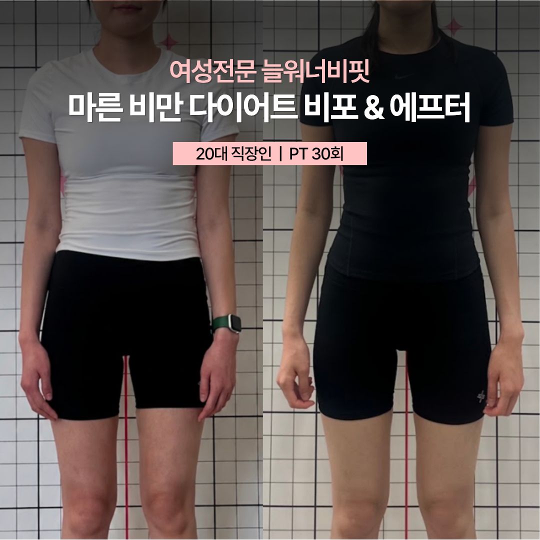 마른 비만 다이어트 비포 애프터, 20대 직장인 · PT 30회