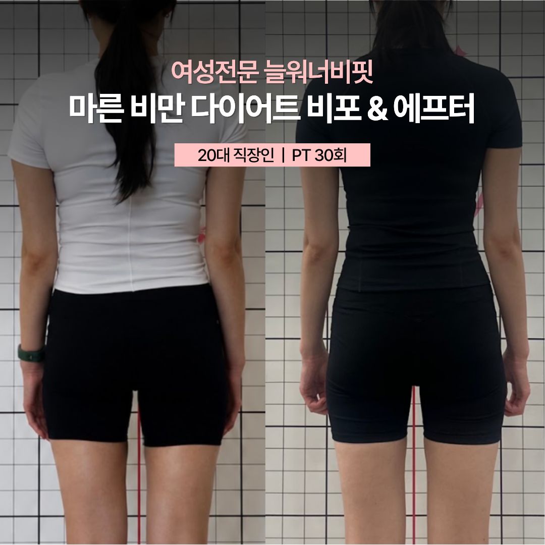 마른 비만 다이어트 비포 애프터, 20대 직장인 · PT 30회