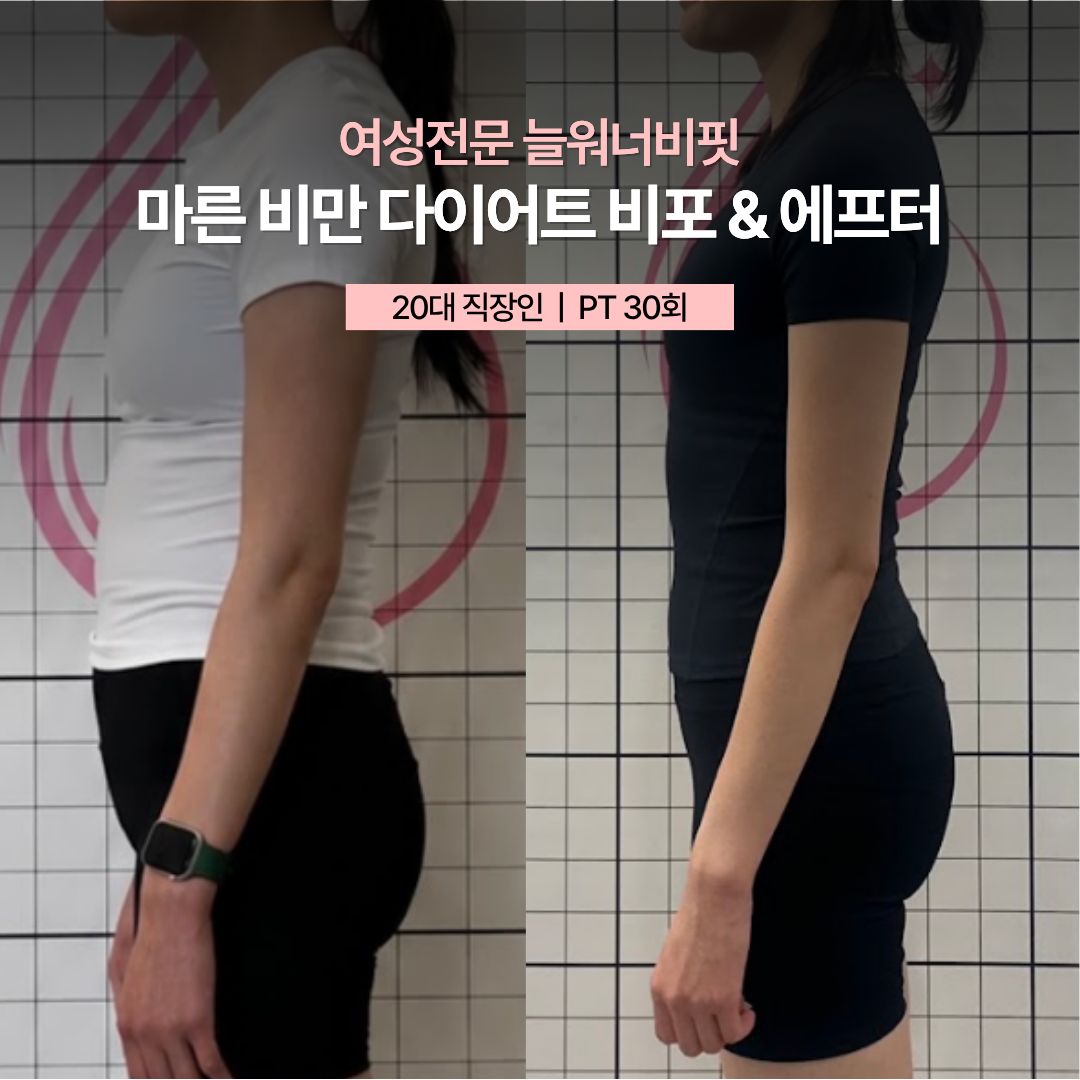 마른 비만 다이어트 비포 애프터, 20대 직장인 · PT 30회